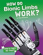 How Do Bionic Limbs Work?