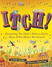 Itch!: Everything You Didn't Want to Know about What Makes You Scratch